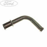 TURBO DRAIN TUBE