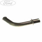 TURBO DRAIN TUBE